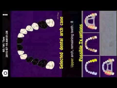 Dental Planner : Tx plan