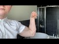 Most insane 16 year old arms-best they have ever looked!