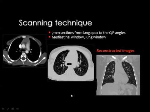 Imaging of pediatric  Chest I    DRE 13   Dr Mamdouh Mahfouz