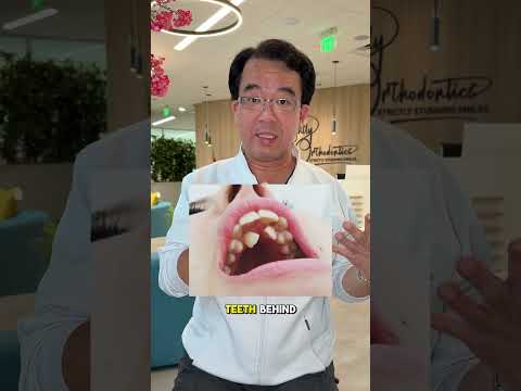 Born with too many teeth? That’s called Hyperdontia 😬 #orthodontist #hyperdontia #teeth #orthotips