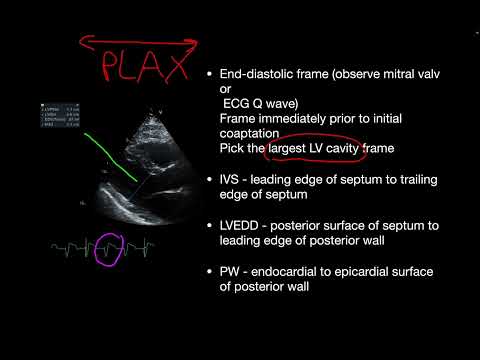 Left ventricular systolic function (global assessment and visual estimation) for ICU