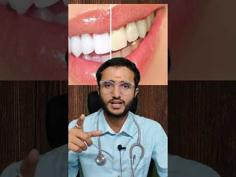 दात मोत्यासारखे पांढरे शुभ्र होतील पिवळे दात पांढरे डॉक्टर फड उपचार #shorts #short #reels #teeth