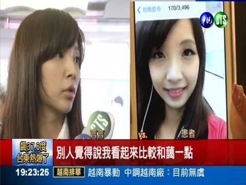 3D列印下巴 手術更加精準安全!