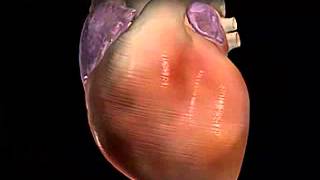 Arrhythmias   Anatomy Video  MedlinePlus Medical Encycl