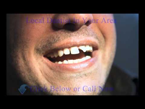 download lagu mp3 mp4 Best Denturists Edmonton, download lagu Best Denturists Edmonton gratis, unduh video klip Best Denturists Edmonton