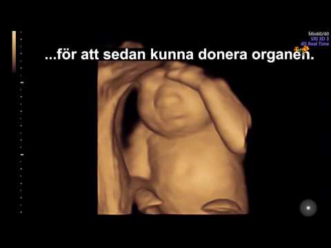 Hon föder sin dödssjuka dotter – för att donera organen