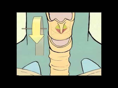 Voice Trix Inside Your Voice - spanish subtitles