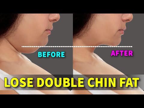 DAY 3 OF 10 | DOUBLE CHIN + FACE FAT + NECK FAT | LOOK YOUNGER WITH BABY FACE