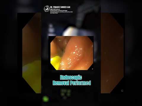 Dr Pinakee Sundar kar Shorts