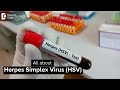 Herpes Simplex Virus (HSV) - Dr. A.V. Lohit  | Doctors' Circle