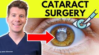 Doctor explains Cataract Surgery | Preparation, procedure and recovery
