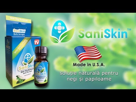 îndepărtarea papilomelor și negilor suplimente de detoxifiere canada
