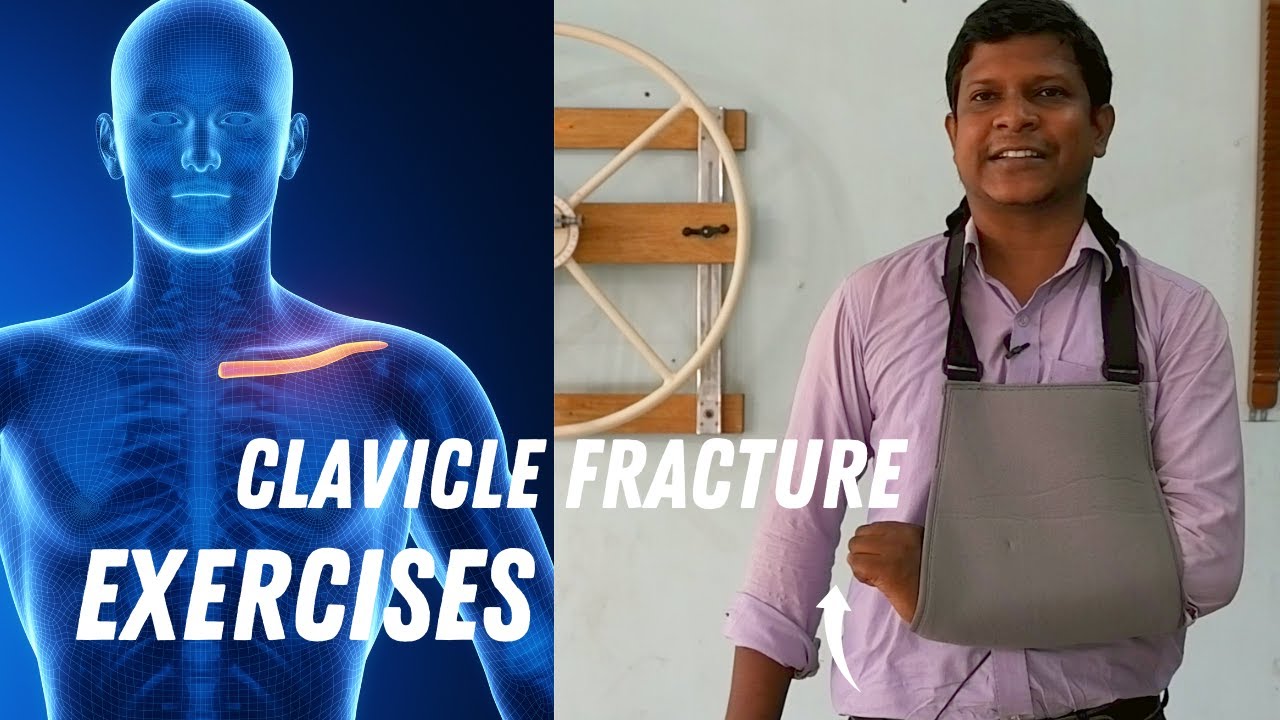 13 Effective Clavicle Bone Fracture Recovery Exercises| Broken Collarbone
