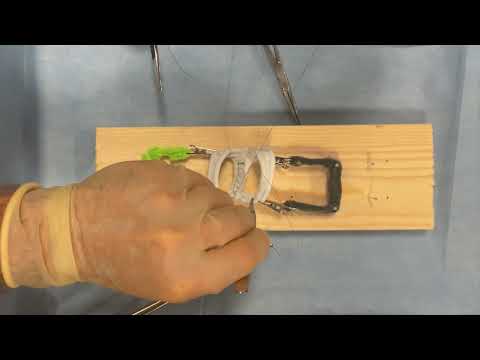 Two-layer Bowel Anastomosis