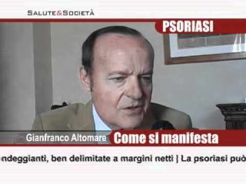 Il vk contro psoriasi per comprare il balsamo 1 pollice Forum di komarovsky e dermatite atopic