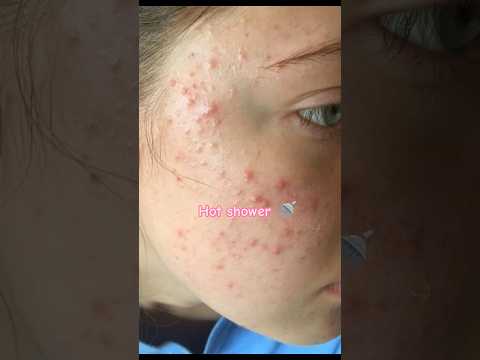 Hot water Vs cold water bath #shorts#coldwaterbenefits#coldshower