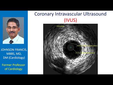 Coronary Intravascular Ultrasound (IVUS)