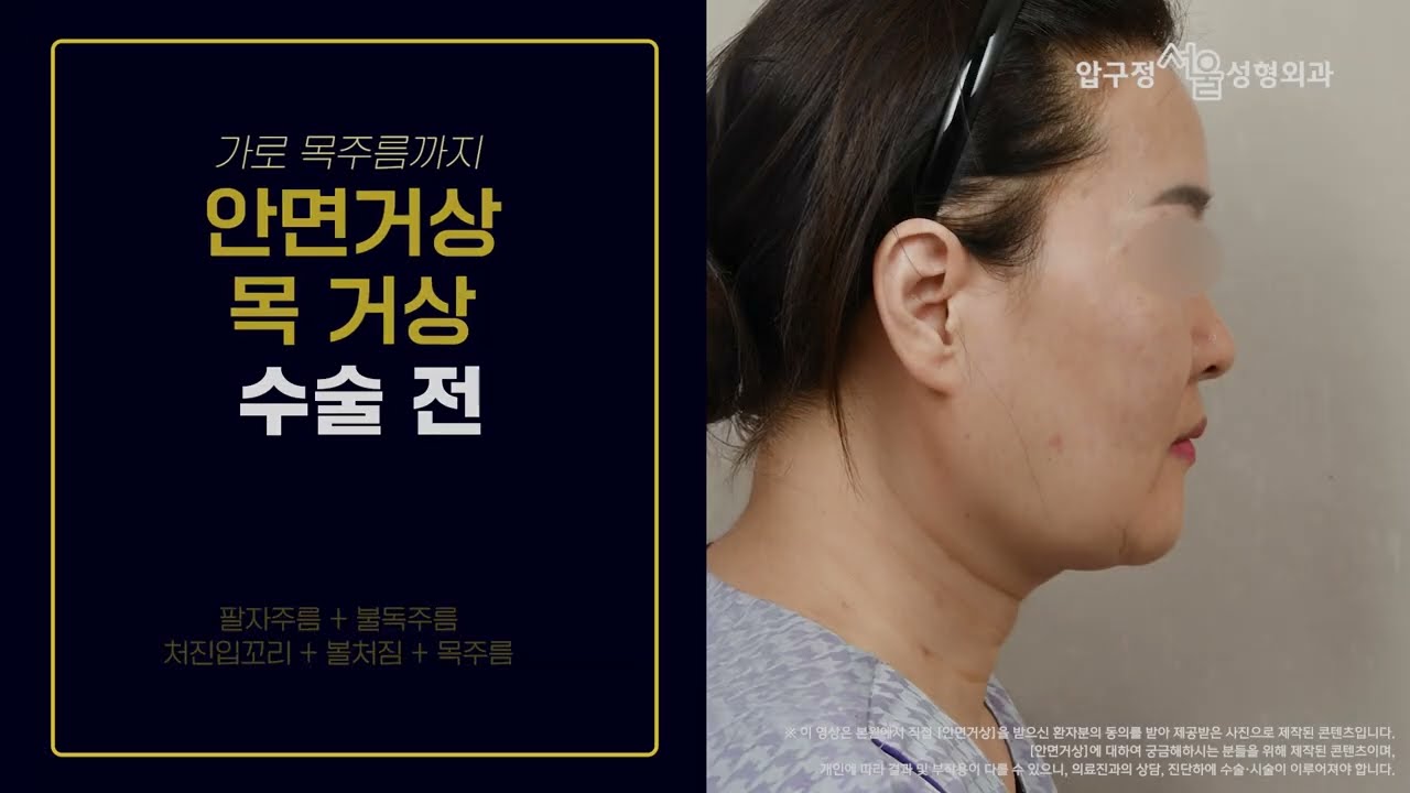 영상 썸네일