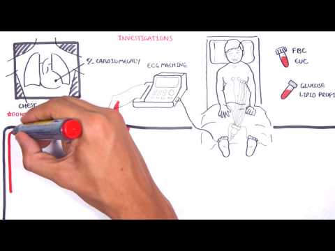 Acute Coronary Syndrome DETAILED Overview (MI, STEMI, NSTEMI