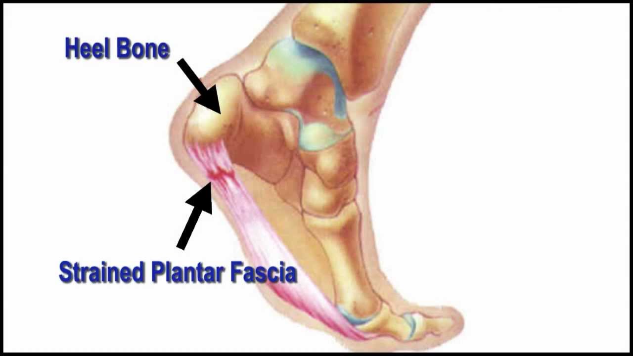 Foot Pain from Standing All Day: Get Relief