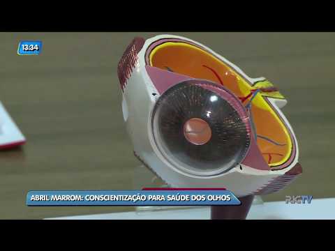 Abril Marrom alerta para a conscientização para a saúde dos olhos