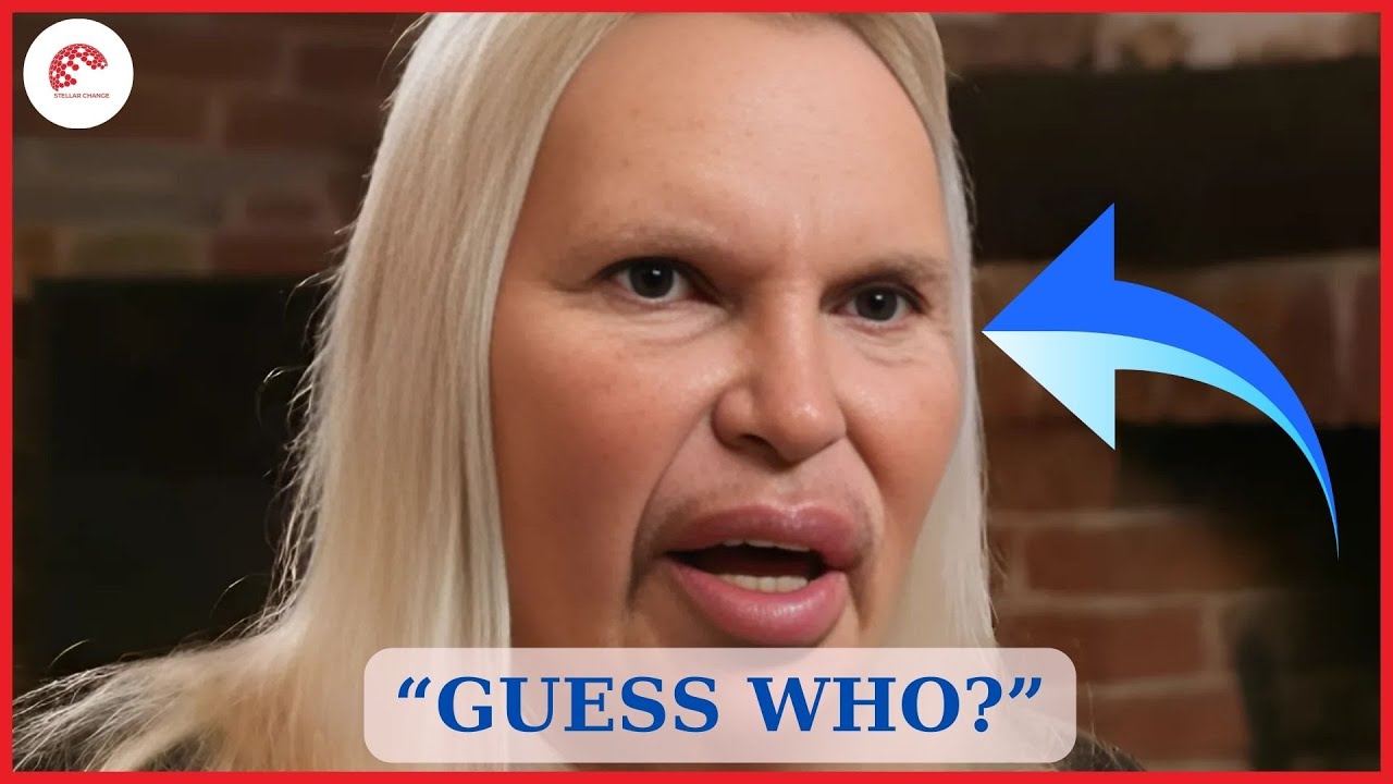 He Was a Famous Actor Before His Plastic Surgery, Guess Who | Then and Now 2025