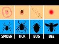 How to Identify a Bug Bite and What to Do With It
