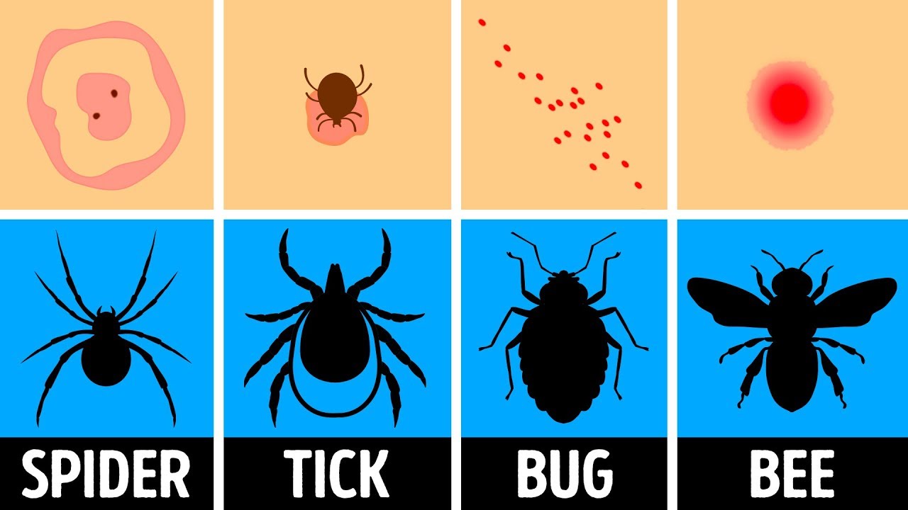 How to Identify a Bug Bite and What to Do With It