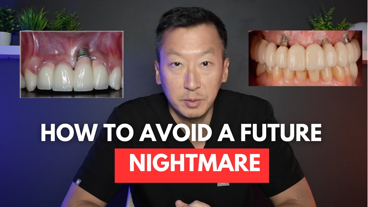 All-on-4? 3-on-6? Snap-on Dentures? Which Full Mouth Dental Implant Solution is for You?