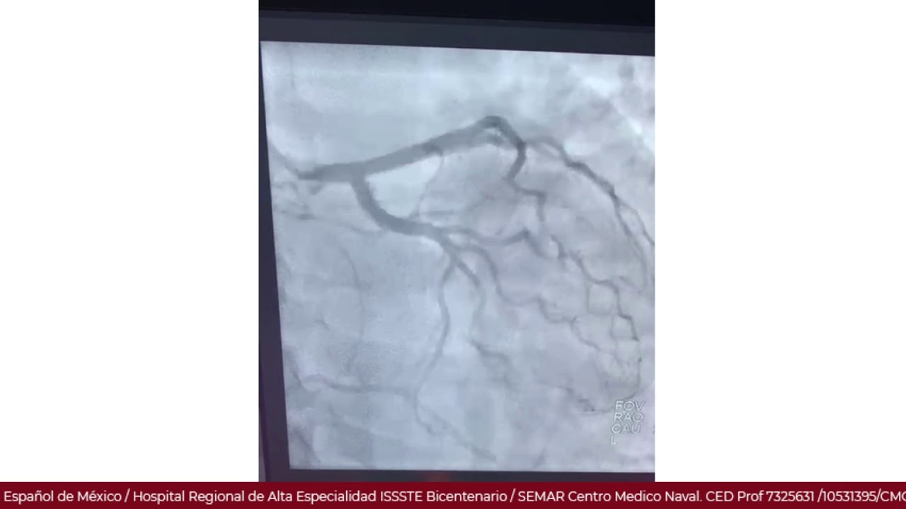 Marcelo Utrera Lagunas-105