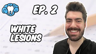 INBDE Question Breakdown - White Lesions | Mental Dental