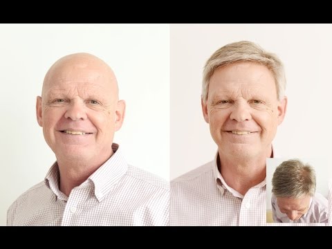 Gary's New Lace Hair Replacement System from Lordhair