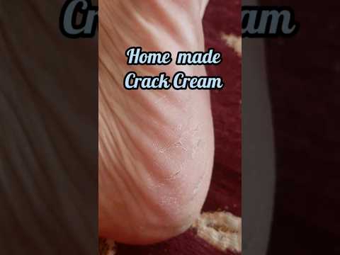 Home made Crack Cream | Winter Hand and Feet Cream | Skin Softner