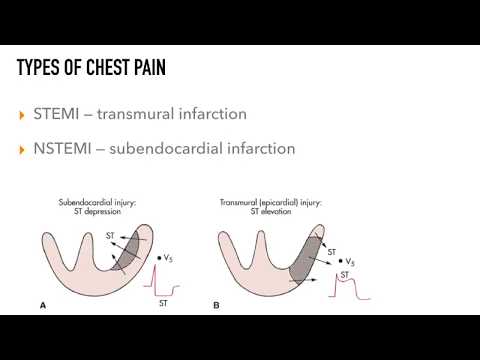 Chest Pain Rapid Review