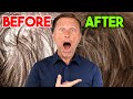 How To Get Thick And Shiny Hair