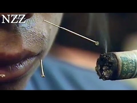 Girudoterapiya Prostata Erotische Geschichte der Prostata