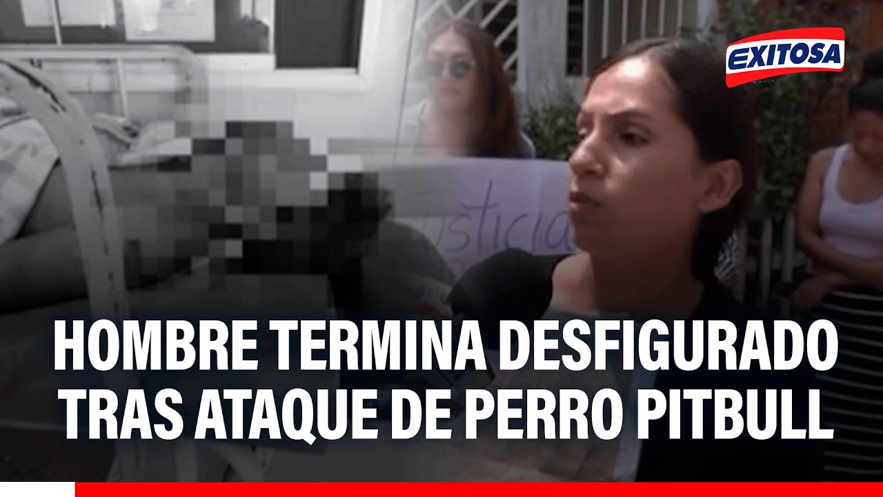 🔴🔵 Hombre termina desfigurado y con más de 100 puntos en el rostro tras ataque de perro pitbull