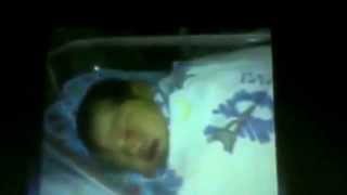 3_ Dr. Faisal - Hemoglobin Derived Pigments Extracellular Depositions Amyloidosis part 2