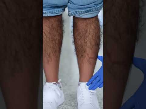 Hairy and Beautiful Norelle ▶0:10