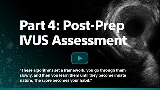 Post-Prep IVUS Assessment, IVUS Part 4 School of Rock