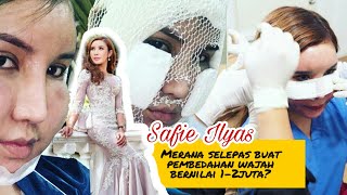 Safie Ilyas berani matii buat pembedahann wajah bernilai 1-2juta?