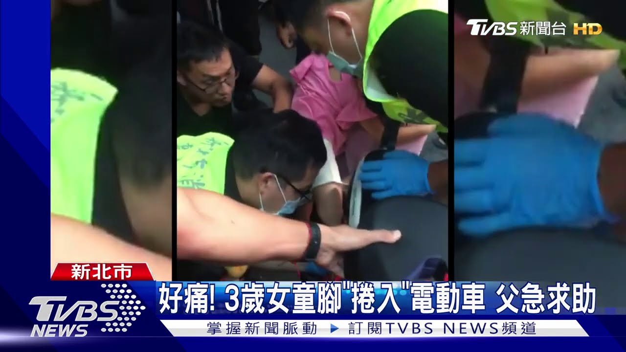 好痛!3歲女童腳「捲入」電動車 父急求助