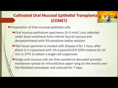 AIOC2021- IC348-Dr.Maj General J K S Parihar- Unfolding future trends & dimensions of limbal ste