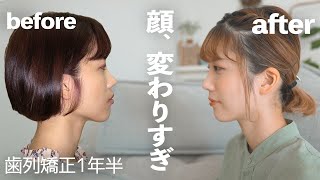 鼻 の 下 線 Watch Hd Mp4 Videos Download Free