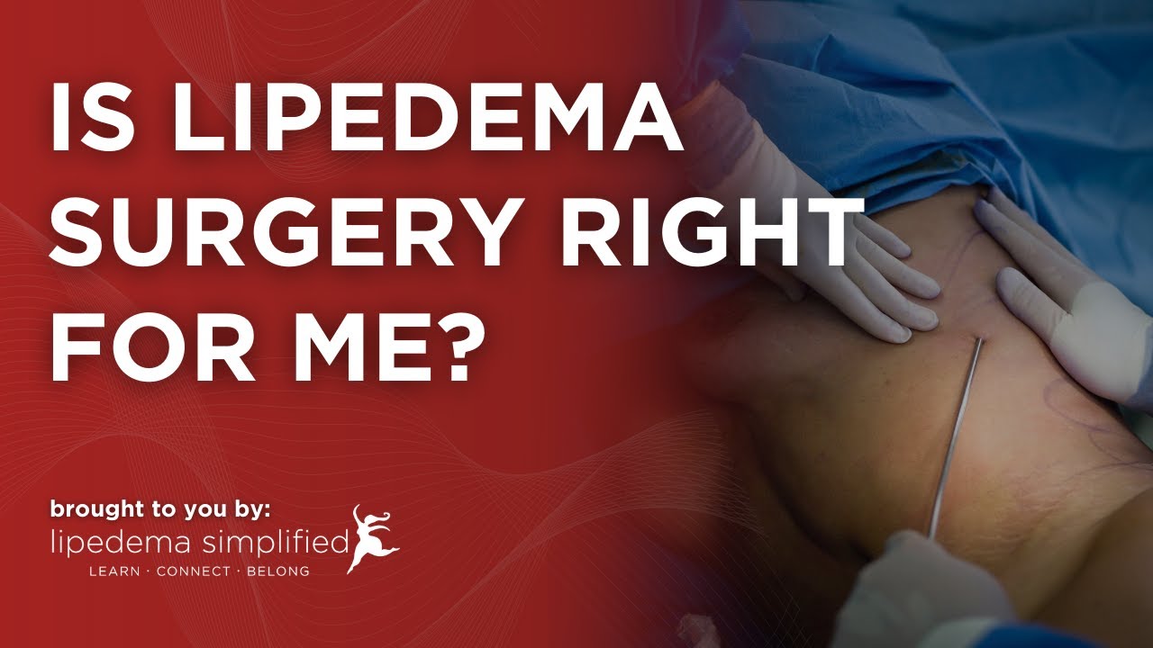 Is Lipedema Surgery Right for ME?