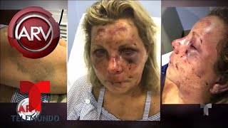 Investigan brutal agresión a mujer en Rep. Dominicana | Al Rojo Vivo