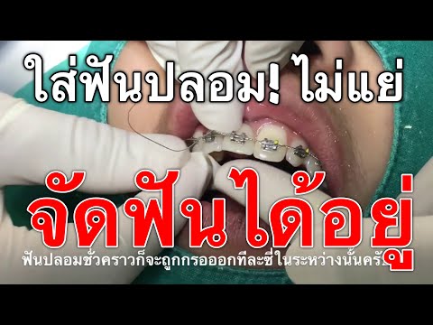 ฉันมีหน้าอกเล็กจ้องมองชาย หน้าอกใหญ่ตามธรรมชาติที่มีหัวนมขนาดเล็ก