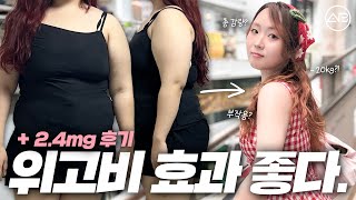 위고비로 20kg 감량했습니다❤️‍🔥