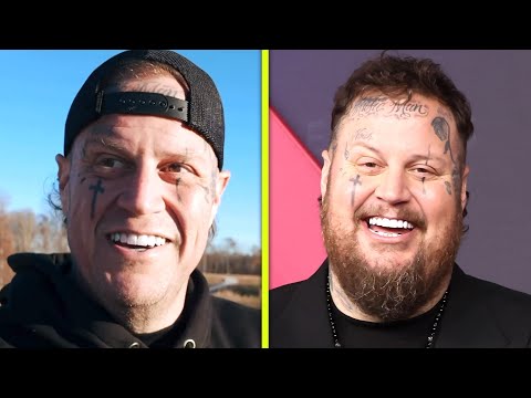 Jelly Roll Shows Off Shaved Face - 99.7 DJX