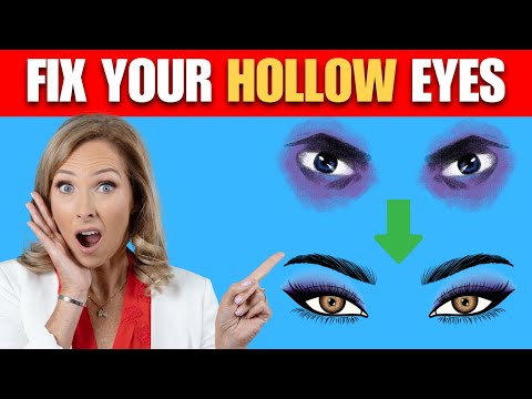 Hollow Eyes? Here's How To Fix Them | Dr. Janine